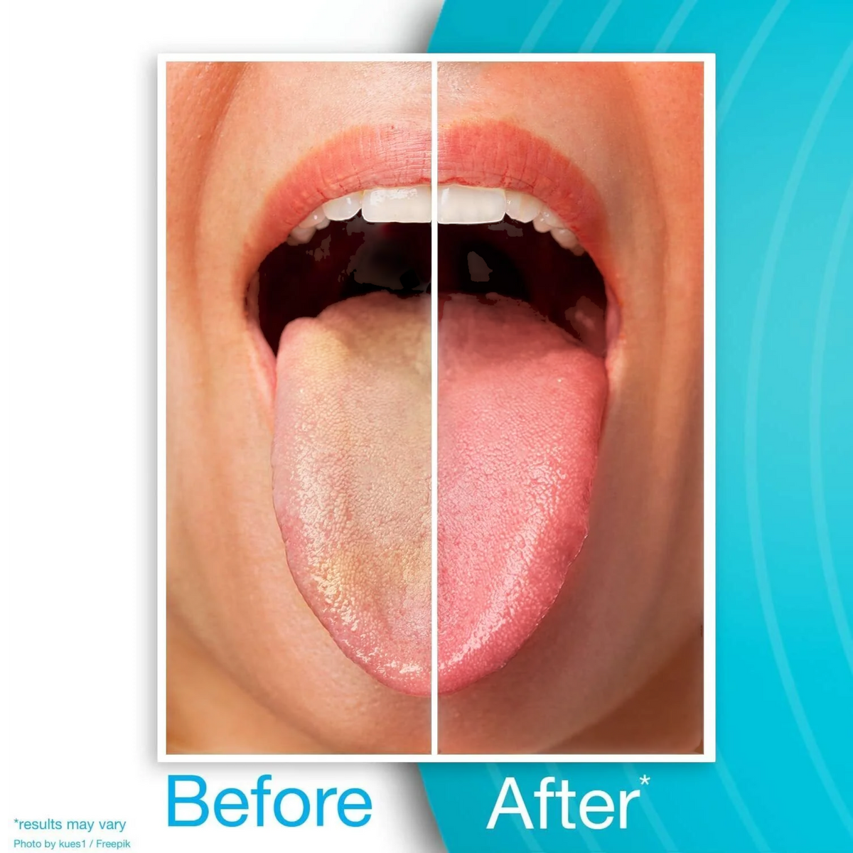 DrTung's Stainless Steel Tongue Cleaner