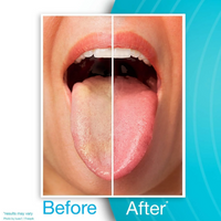 DrTung's Stainless Steel Tongue Cleaner